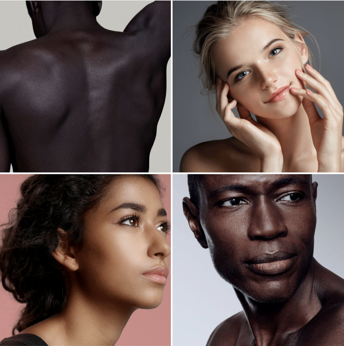 Monika, laser practitioner at Luminier, offering Nd:YAG laser hair removal for dark skin in Leighton Buzzard